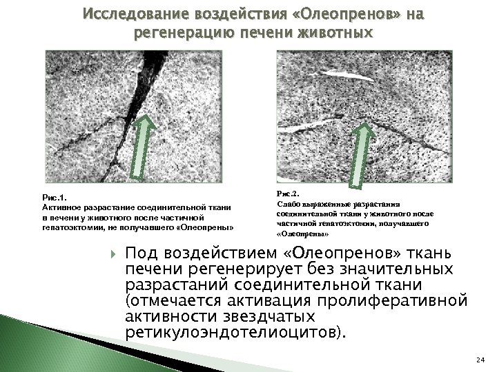 Исследование воздействия «Олеопренов» на регенерацию печени животных Рис. 1. Активное разрастание соединительной ткани в