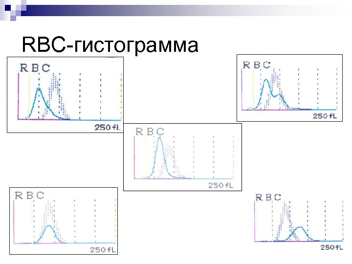 RBC-гистограмма 