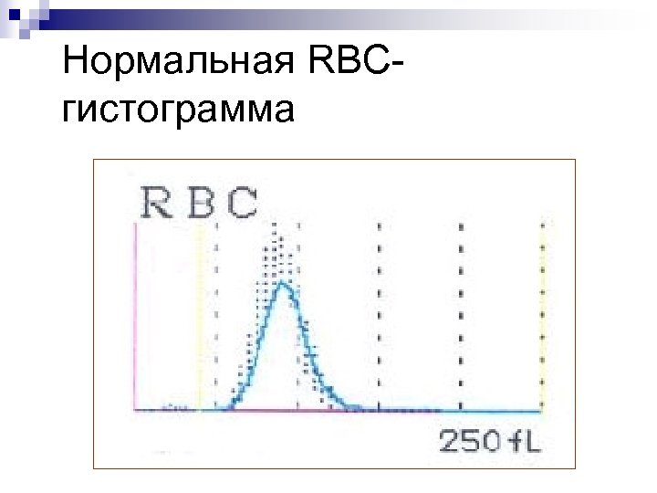 Нормальная RBCгистограмма 
