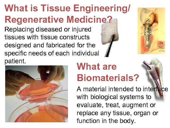 What is Tissue Engineering/ Regenerative Medicine? Replacing diseased or injured tissues with tissue constructs