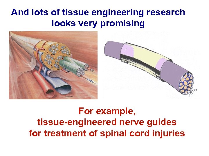 And lots of tissue engineering research looks very promising For example, tissue-engineered nerve guides