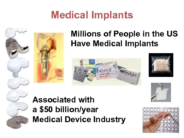 Medical Implants Millions of People in the US Have Medical Implants Associated with a