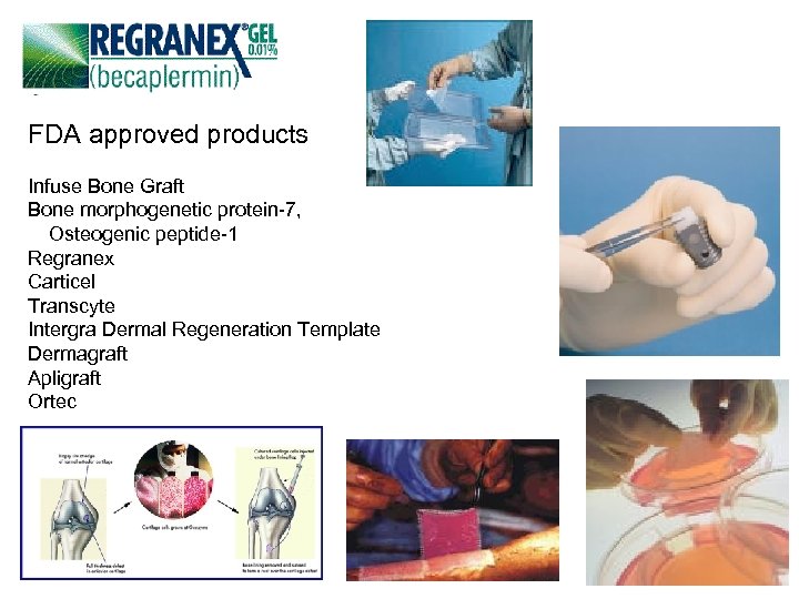 FDA approved products Infuse Bone Graft Bone morphogenetic protein-7, Osteogenic peptide-1 Regranex Carticel Transcyte