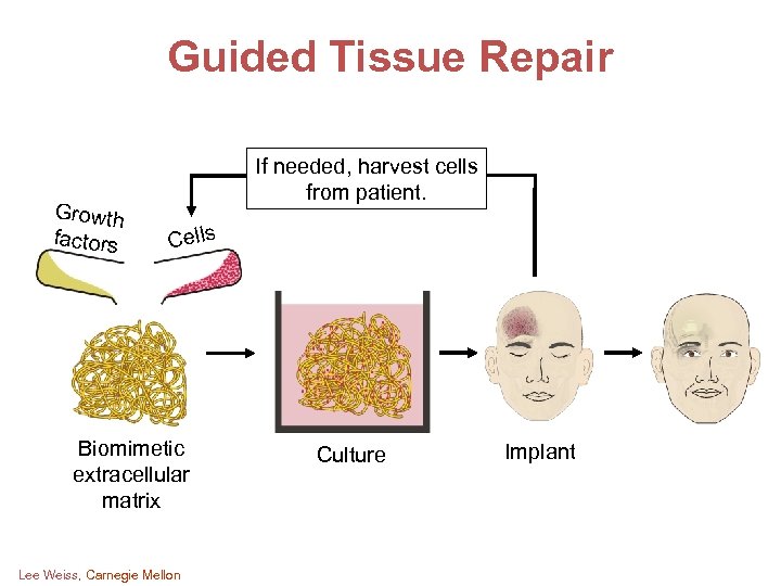 Guided Tissue Repair Growth factors If needed, harvest cells from patient. Cells Biomimetic extracellular