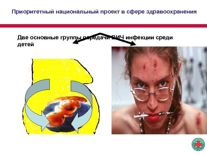 Приоритетный национальный проект в сфере здравоохранения Две основные группы передачи ВИЧ инфекции среди детей
