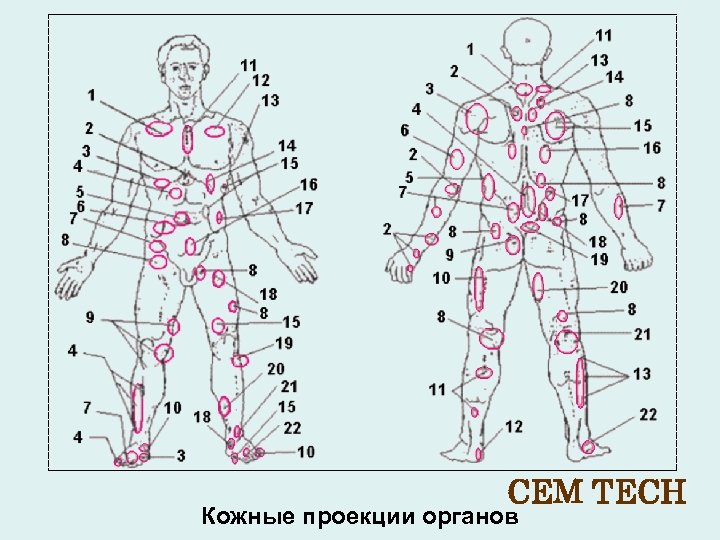 Лимфоузлы на теле человека расположение у женщин схема