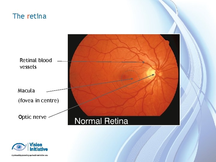 The retina Retinal blood vessels Macula (fovea in centre) Optic nerve 