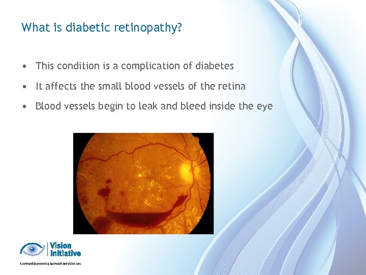 What is diabetic retinopathy? • This condition is a complication of diabetes • It