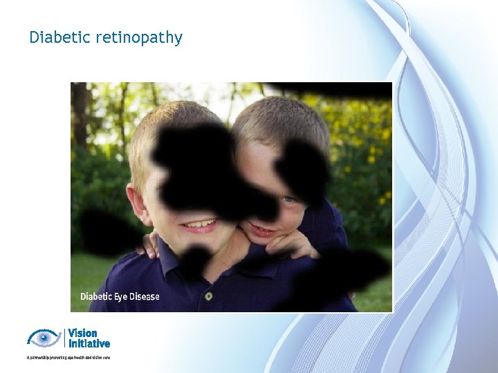 Diabetic retinopathy 