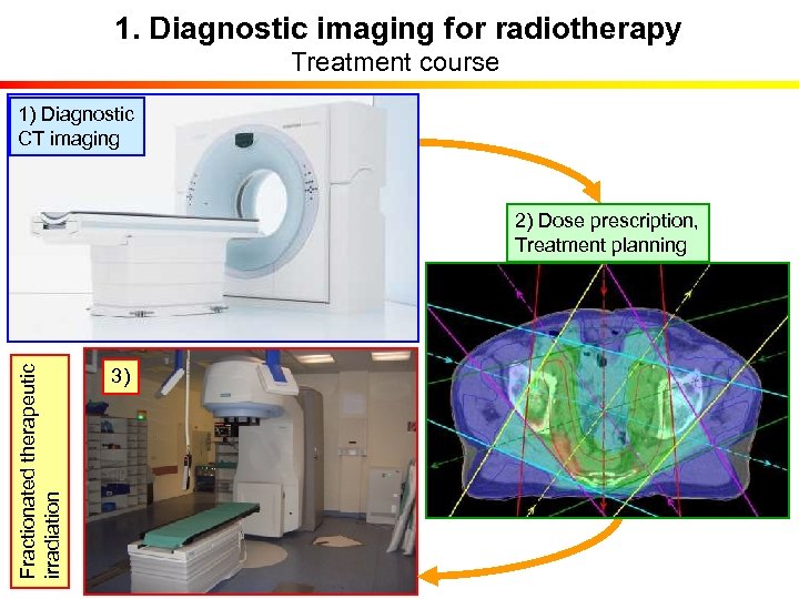 1. Diagnostic imaging for radiotherapy Treatment course 1) Diagnostic CT imaging Fractionated therapeutic irradiation