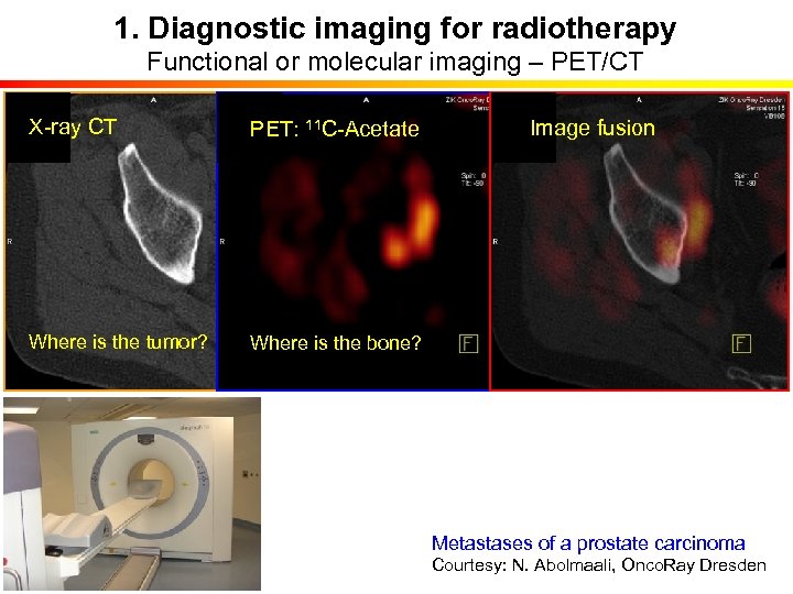 1. Diagnostic imaging for radiotherapy Functional or molecular imaging – PET/CT X-ray CT PET: