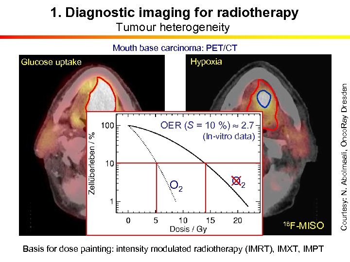1. Diagnostic imaging for radiotherapy Tumour heterogeneity Mouth base carcinoma: PET/CT OER (S =