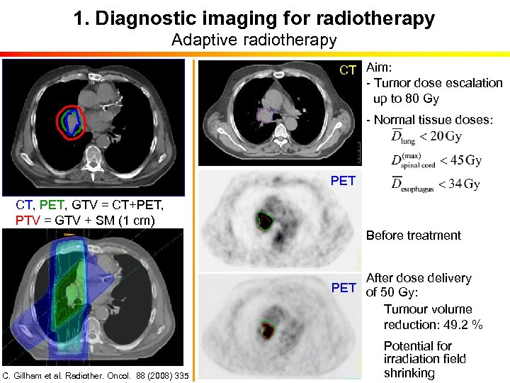 1. Diagnostic imaging for radiotherapy Adaptive radiotherapy CT Aim: - Tumor dose escalation up