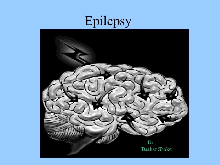 Epilepsy Dr. Bashar Shaker 