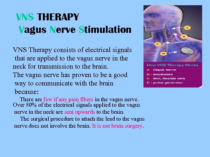 VNS THERAPY Vagus Nerve Stimulation VNS Therapy consists of electrical signals that are applied