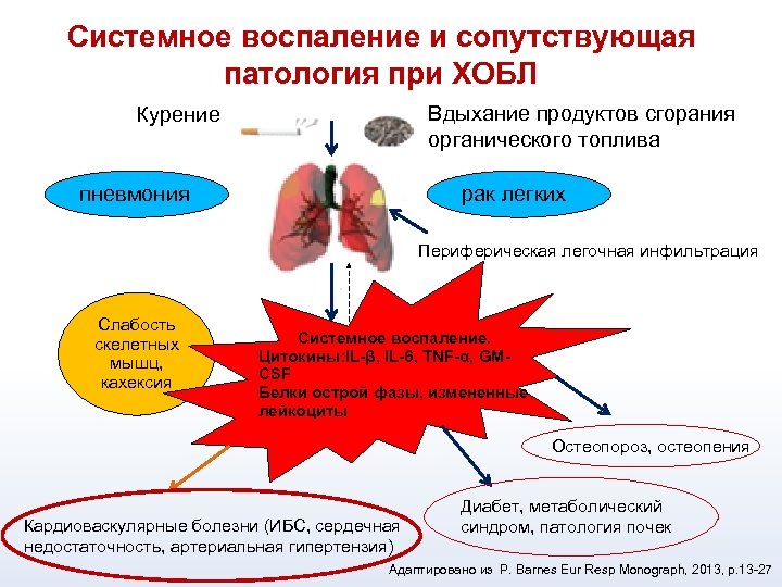 Образец диагноза хобл