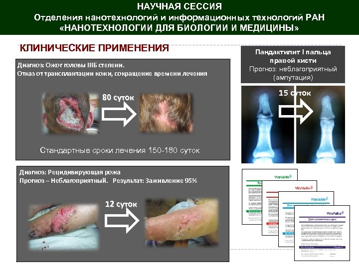 НАУЧНАЯ СЕССИЯ Отделения нанотехнологий и информационных технологий РАН «НАНОТЕХНОЛОГИИ ДЛЯ БИОЛОГИИ И МЕДИЦИНЫ» КЛИНИЧЕСКИЕ