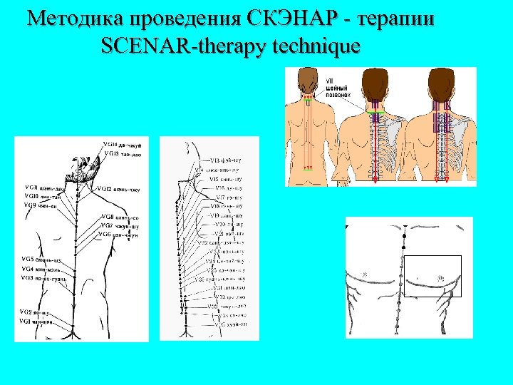 Методика проведения СКЭНАР - терапии SCENAR-therapy technique 