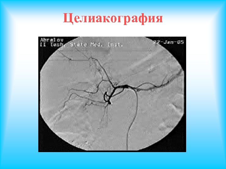 Целиакография 