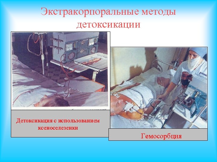 Экстракорпоральные методы детоксикации Детоксикация с использованием ксеноселезенки Гемосорбция 