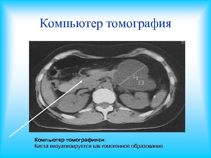 Проблемы со стулом при панкреатите