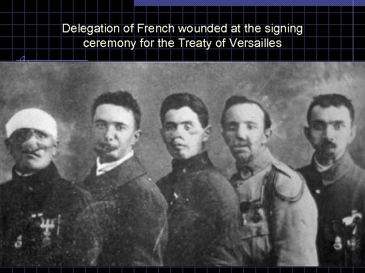 Delegation of French wounded at the signing ceremony for the Treaty of Versailles 