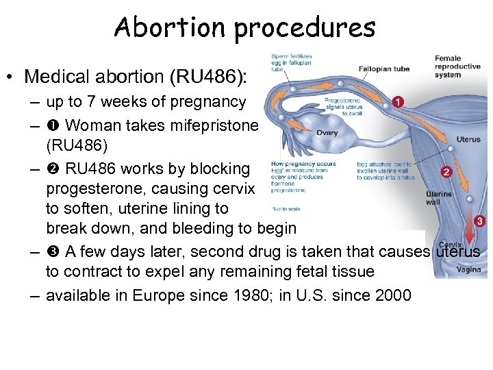 Abortion procedures • Medical abortion (RU 486): – up to 7 weeks of pregnancy