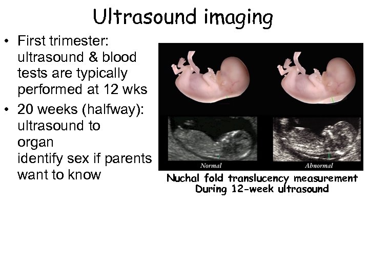 Ultrasound imaging • First trimester: ultrasound & blood tests are typically performed at 12
