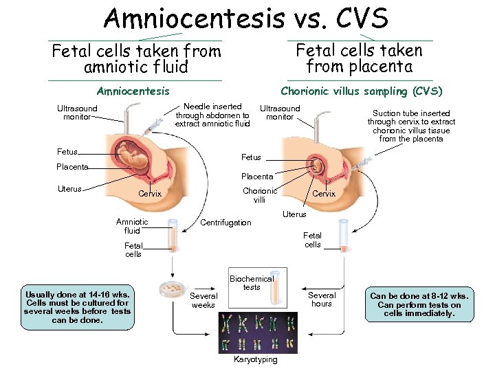 Amniocentesis vs. CVS Fetal cells taken from amniotic fluid Fetal cells taken from placenta