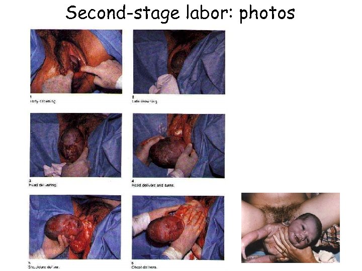 Second-stage labor: photos 
