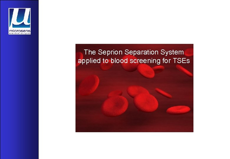 The Seprion Separation System applied to blood screening for TSEs 