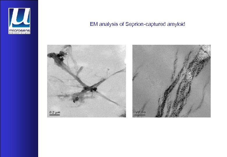 EM analysis of Seprion-captured amyloid 