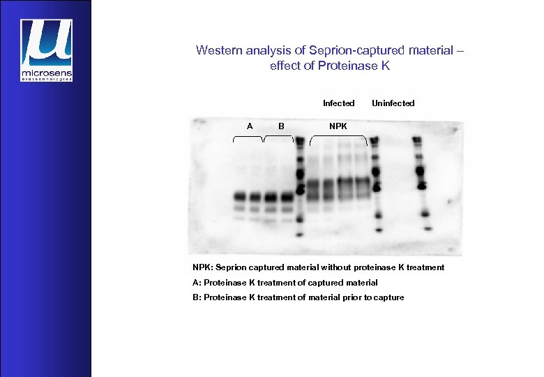 Western analysis of Seprion-captured material – effect of Proteinase K Infected A B Uninfected