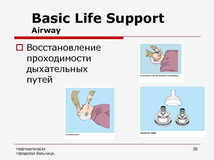 Basic Life Support Airway o Восстановление проходимости дыхательных путей Нефтеюганская городская больница. 26 