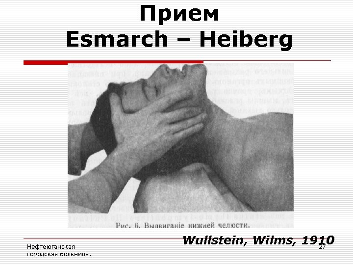 Прием Esmarch – Heiberg Нефтеюганская городская больница. Wullstein, Wilms, 1910 27 