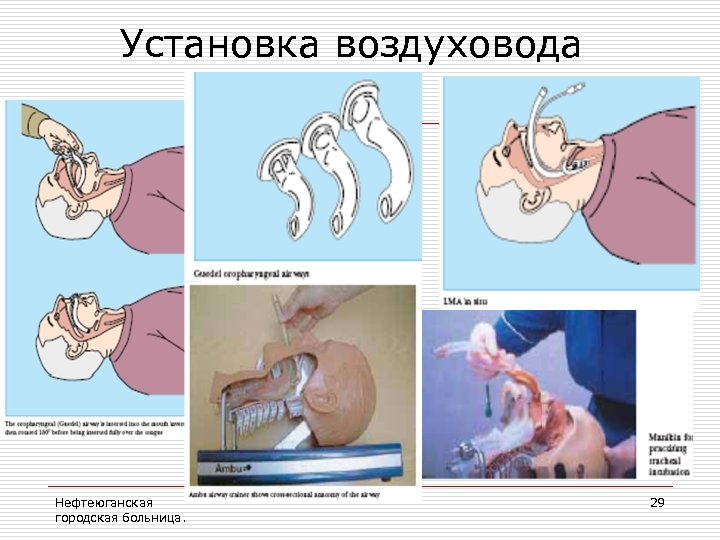 Установка воздуховода Нефтеюганская городская больница. 29 