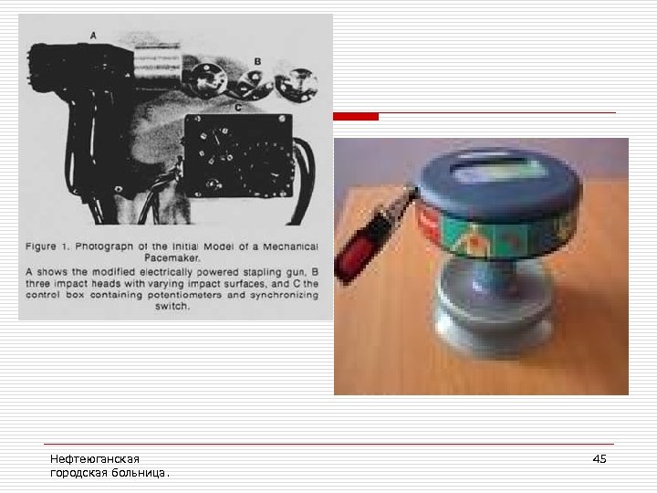 Нефтеюганская городская больница. 45 