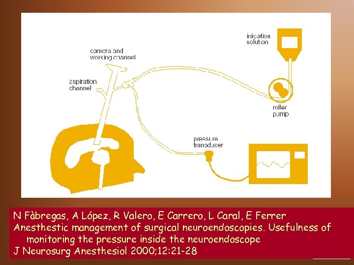 N Fàbregas, A López, R Valero, E Carrero, L Caral, E Ferrer Anesthestic management