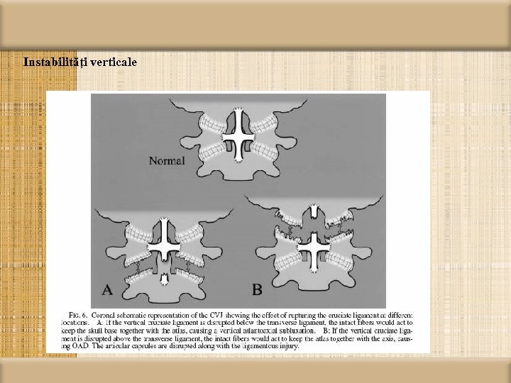 Instabilităţi verticale 