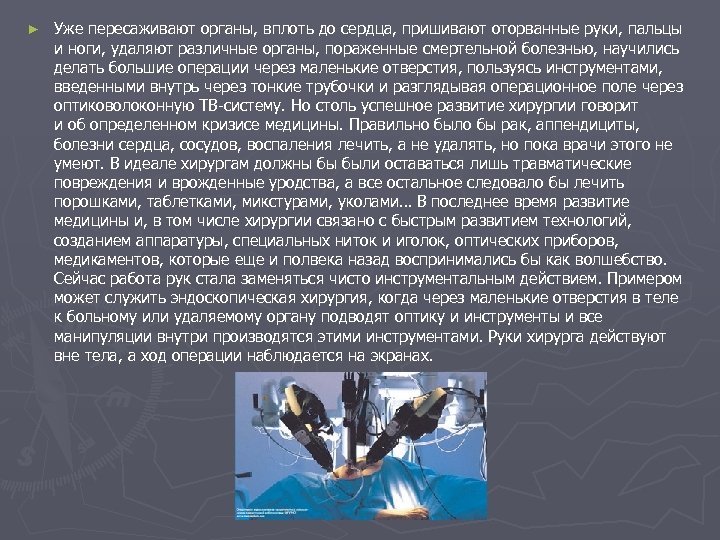 ► Уже пересаживают органы, вплоть до сердца, пришивают оторванные руки, пальцы и ноги, удаляют