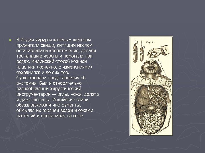 ► В Индии хирурги каленым железом прижигали свищи, кипящим маслом останавливали кровотечение, делали трепанацию