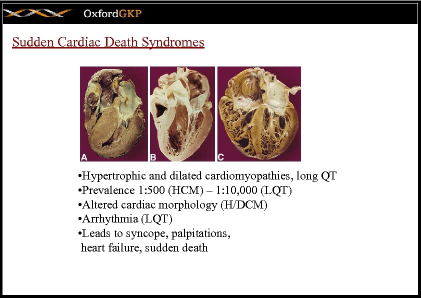 Sudden Cardiac Death Syndromes • Hypertrophic and dilated cardiomyopathies, long QT • Prevalence 1: