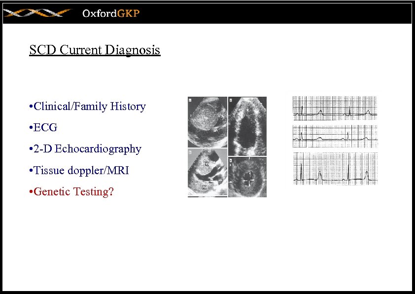 SCD Current Diagnosis • Clinical/Family History • ECG • 2 -D Echocardiography • Tissue