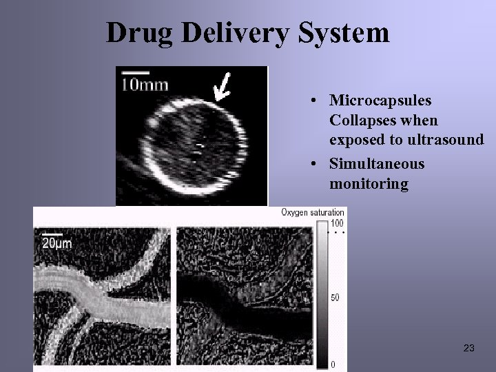 Drug Delivery System • Microcapsules Collapses when exposed to ultrasound • Simultaneous monitoring 23