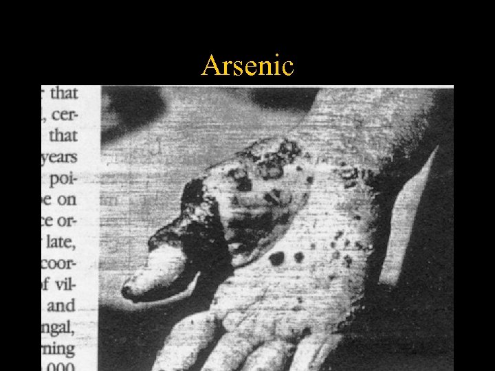 Arsenic 