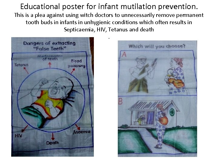 Educational poster for infant mutilation prevention. This is a plea against using witch doctors