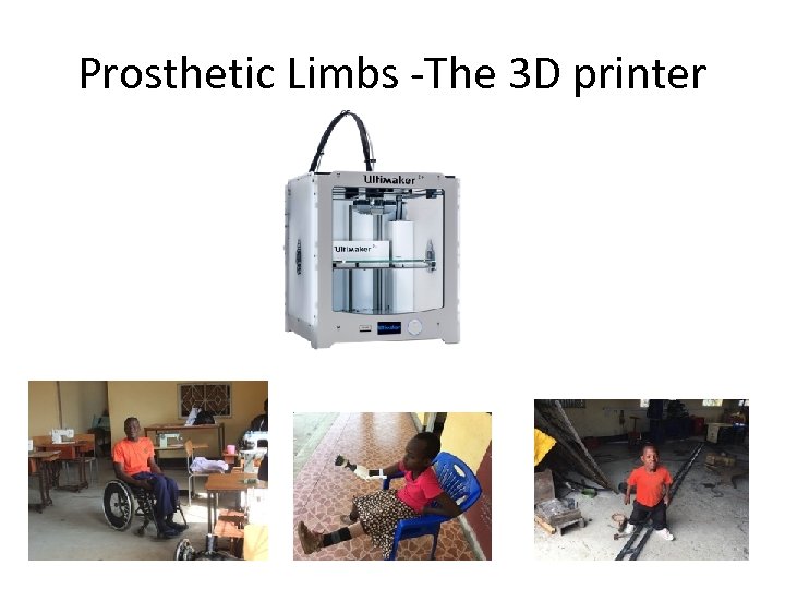 Prosthetic Limbs -The 3 D printer 