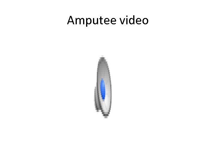 Amputee video 