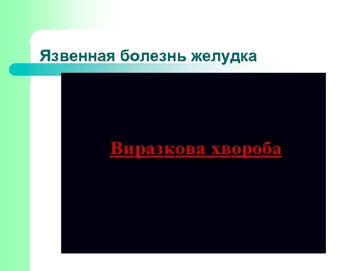 Язвенная болезнь желудка 