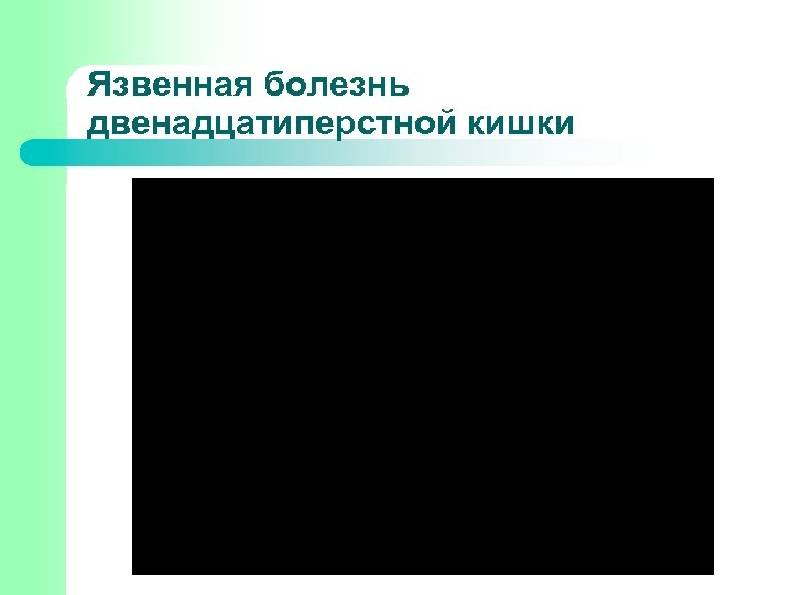 Язвенная болезнь двенадцатиперстной кишки 